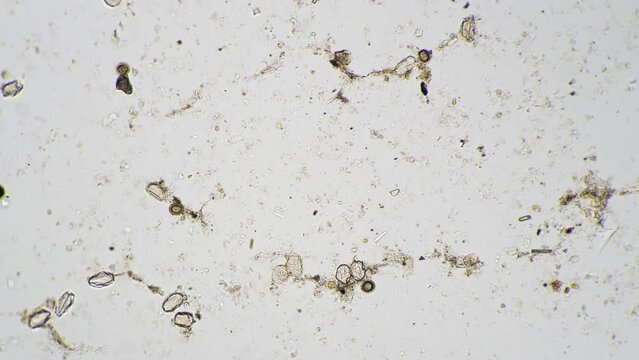 Whole mount of Taenia solium eggs under microscope on white background with 100 times magnification. Macro view of pork tapeworm on scientific slide for studying. Parasites in environment. Pests theme