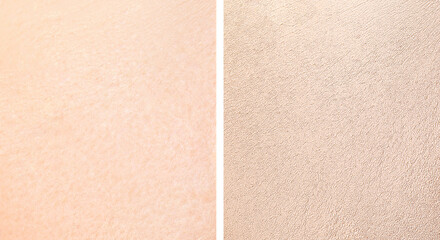 Fototapeta premium Collage with photos of dry and moisturized skin texture
