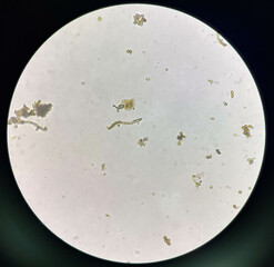Budding yeast cell in nature.