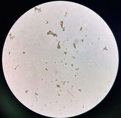 Budding yeast cell in nature.