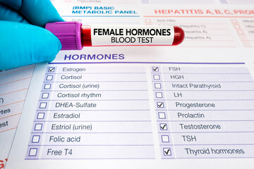 doctor holding blood sample for analysis of Female Hormones test. Requisition form with Blood test...
