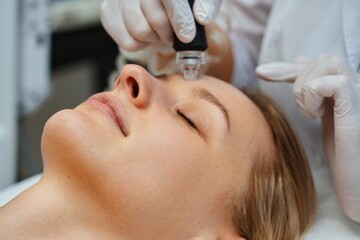 Obraz na płótnie Canvas A cosmetologist performs hydropiling in a beauty salon. Skin care.