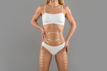 Body Shaping. Slim Woman In Underwear With Drawn Lifting Lines On Torso - obrazy, fototapety, plakaty