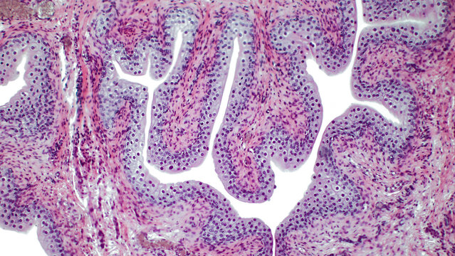 Transitional Epithelium. Light Microscopy Of The Internal Lining Of The Urinary Bladder. Haematoxylin And Eosin Stain. 