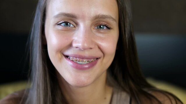 Beautiful smiling girl with brackets for teeth. Smiling woman. Female smile with dental braces close up. Braces Mouth
