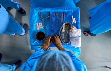 top view of the table with instruments in the operating room