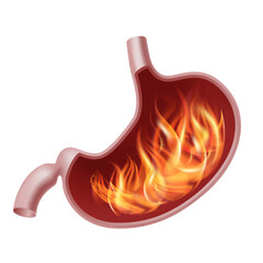 Burning stomach. Realistic human organ of internal digestion system on fire.