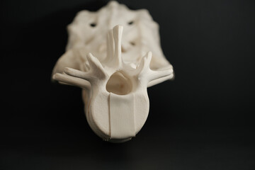 Lumbar Spine