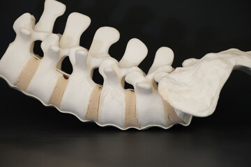 Lumbar Spine