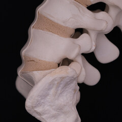 Lumbar Spine