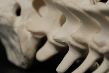Lumbar Spine