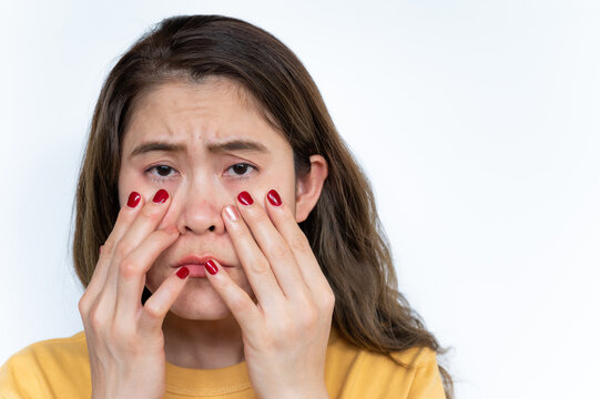 Portrait Of Asian Woman Worried About Her Acne And Wrinkled Occur On Her Face. Wrinkles Are Creases, Folds, Or Ridges In The Skin. They Naturally Appear As People Get Older.