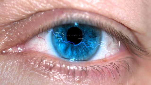  Trader eye