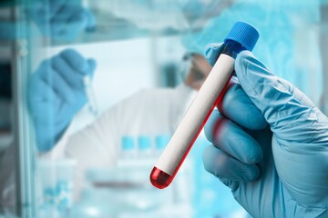 Hand researcher with blood tube. Analysis lab concept