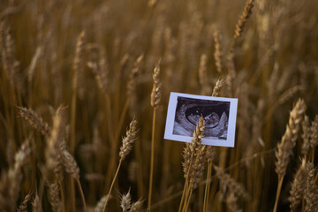 ultrasound image of a baby 