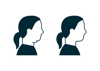 Double chin of woman icon, change in facial aesthetics. Fat loss in overweight on face. Profile girl before and after liposuction, lifting, plastic procedure. Vector illustration - obrazy, fototapety, plakaty