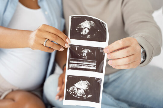 Closeup multiethnic pregnant couple demonstrate baby sonography photo while relaxing together at home. Showing first photo of their child, enjoying future parenthood excited on seeing baby ultrasound.