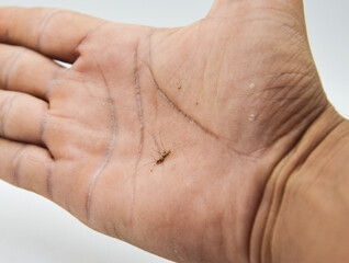 Fototapeta premium dead mosquito on hand concept dengue fever malaria