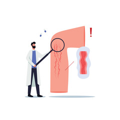 Vein Thrombosis and Varicose Treatment Concept. Tiny Doctor Character Stand on Ladder with Magnifying Glass Looking on Huge Foot with Diseased Veins. Health Care, Podiatry. Cartoon Vector Illustration