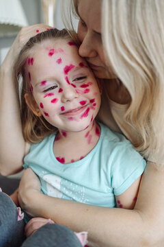 Little girl ill with chickenpox at home. High quality photo
