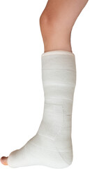 Woman with her broken leg. leg in a cast on isolated white background. Close up