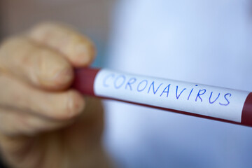 Obraz premium Hand holding blood test result for Coronavirus