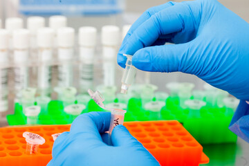 Closeup of scientist hands while extracting DNA using the spin column-based nucleic acid...
