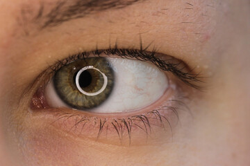 Hazel is the eye of a middle-aged Slavic woman.A black floating spot in the eye as a symptom of...