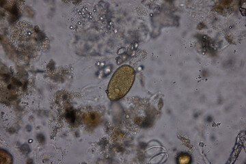 Eggs of helminth and Finding parasites in feces, analyze by microscope in laboratory.