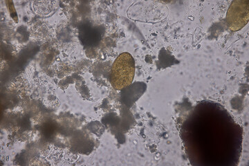 Eggs of helminth and Finding parasites in feces, analyze by microscope in laboratory.