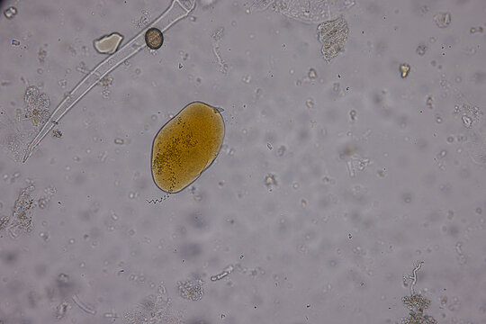 Eggs of helminth and Finding parasites in feces, analyze by microscope in laboratory.