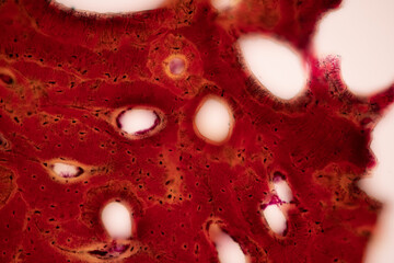Connective tissue human and Striated muscle human under the microscope in Lab.
