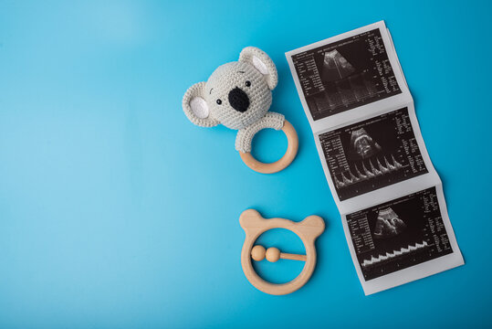 ultrasound picture with toys on blue bacground