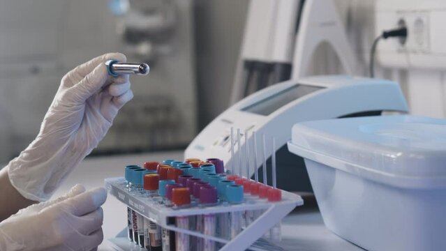 Close-up of the Hand in Glove Taking Test Tube With Blood Samples. Material for Laboratory Testing or Experiments. Concept: Research, Biochemistry, Pharmaceutical Medicine