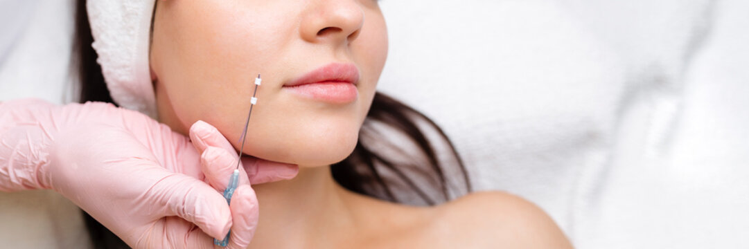 Face lifting PDO Suture operation. innovative technique of New thread lift, cosmetologist preparing to do procedure to female client, select the appropriate thread option