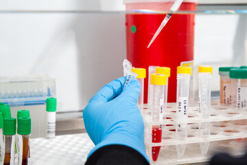 Scientist preparing blood samples for karyotipe and fluorescence in situ hybridization in the ...