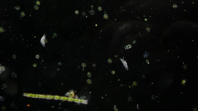 Drop of fresh water under a microscope. The simplest organisms and unicellular algae in an amazing microcosm. Water from a mountain stream.