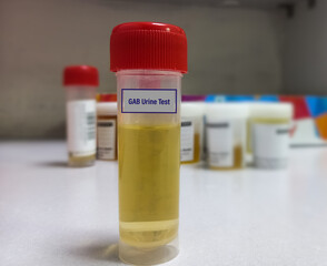 Urine sample for GAB(Gabapentin) urine test. Set therapeutic dose. Epilepsy, seizures.