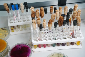 Almaty, Kazakhstan - 08.15.2022 : Flasks with viral markers in the laboratory.