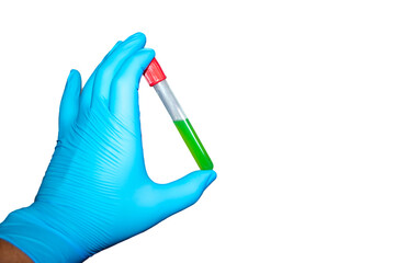 Hand with latex surgical glove holds sealed test tube with green liquid on white background. medical advertising concept