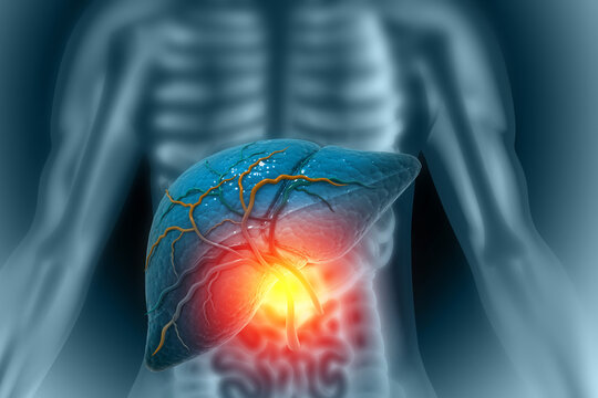 Human liver anatomy structure, diseased liver, 3d illustration