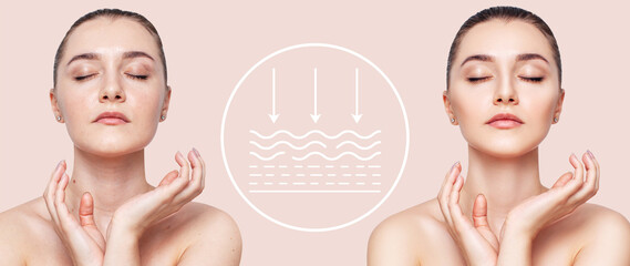 Woman before and after lifting skin. Infographic shows deep penetration of remedy in skin.