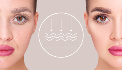Woman before and after lifting skin. Infographic shows deep penetration of remedy in skin.