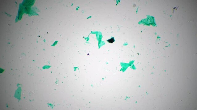 Macro footage of nostoc whole mount magnified in 40 times by microscope on bright field. Green cyanobacterium living in freshwater filmed under special lab equipment for the biological education.