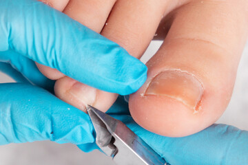 A chiropodist gives a pedicure to the client's feet, cutting dry skin with clippers. Close up. The concept of foot care and chiropody