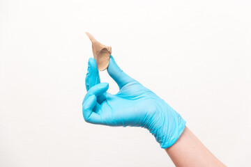 Podiatrist in blue gloves show a silicone impression for correction ingrown nails on toe fingers....