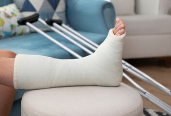 broken ankle and a leg cast. Leg splint - obrazy, fototapety, plakaty