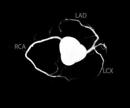 CT Cardiac 3D Or CTA Coronary Artery