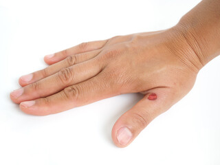 Female fingers are wounded. Health concept. Closeup photo, blurred.