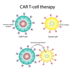 Obraz premium CAR T-cell therapy and Cancer treatment . Cancer therapy. CAR T cells immunotherapy. Chimeric antigen receptor T cells. T cell receptor proteins that have been engineered to kill cancer cells. Vector